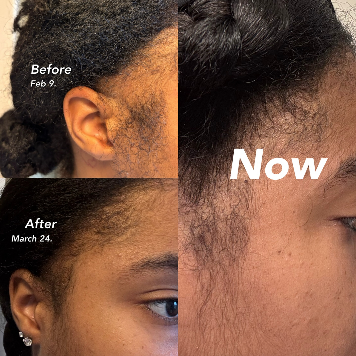 Raw, Organic Batana Oil for Thicker, Stronger Hair β 120 mL