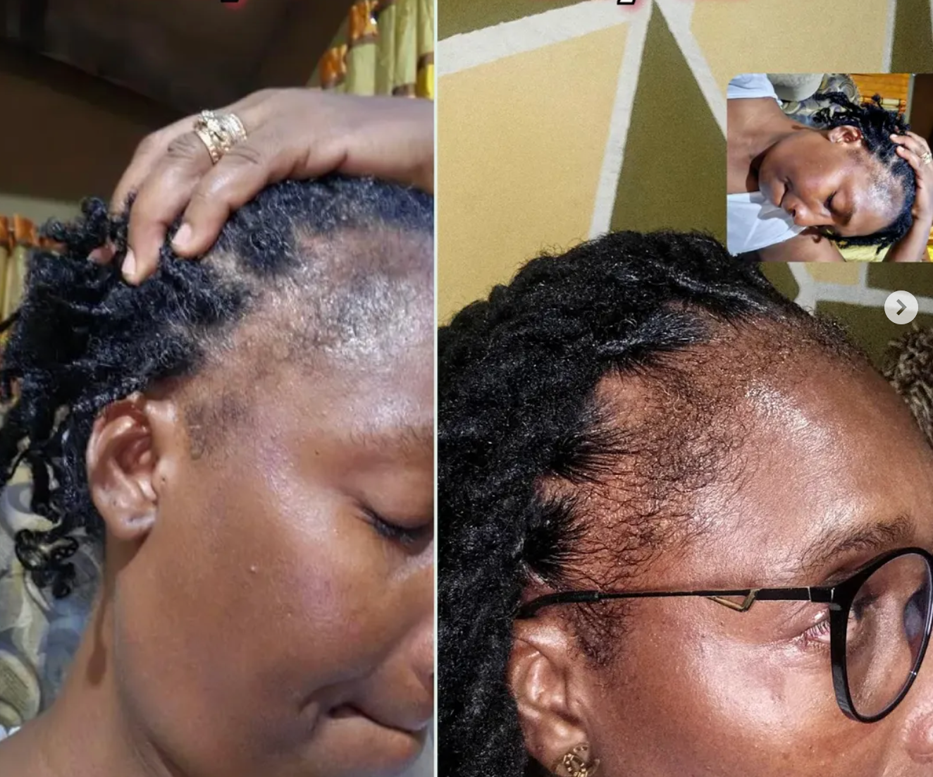 Batana Oil Natural Hair Growth – 120 mL