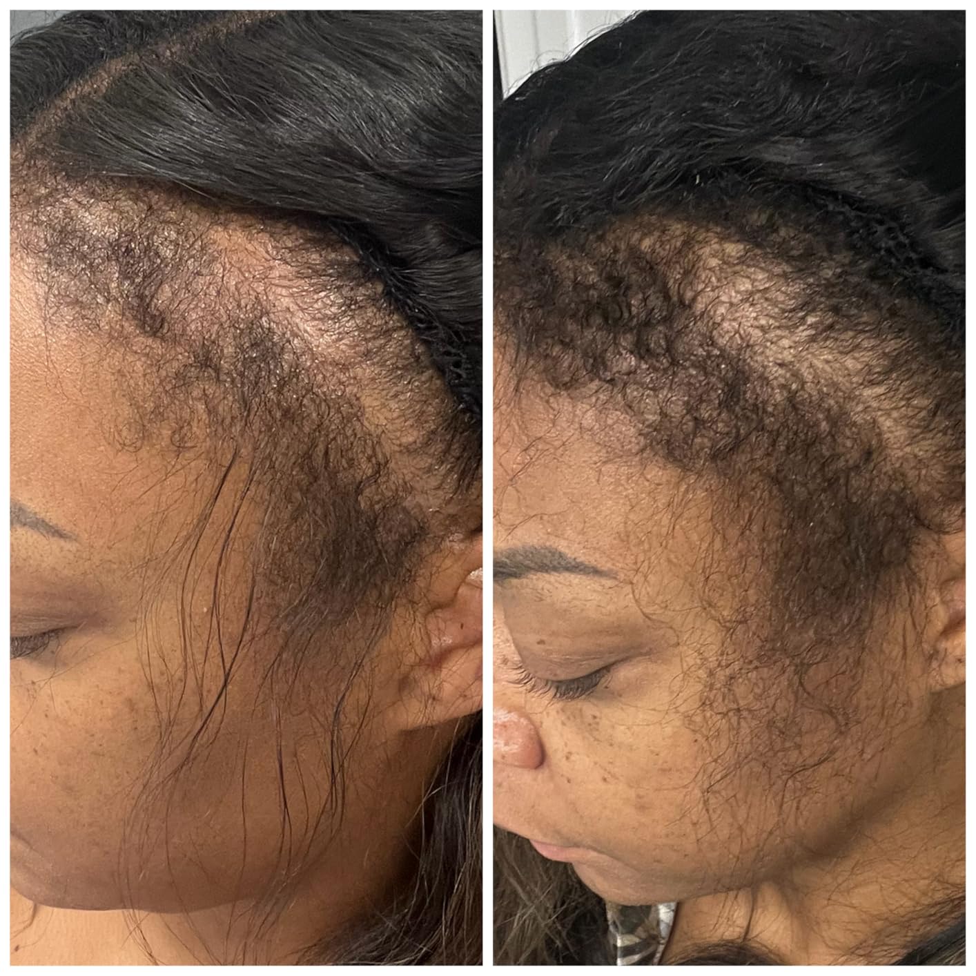 Batana Oil Natural Hair Growth – 120 mL