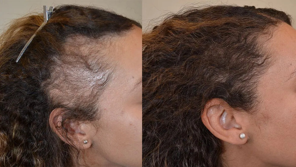 Before and after hair transformation